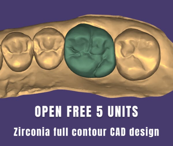 Digital Dental CAD Design Outsourcing Services