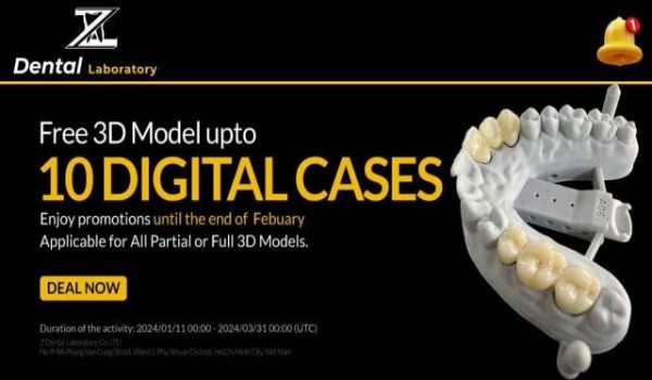 Free 3D Model Up To 10 Digital Cases