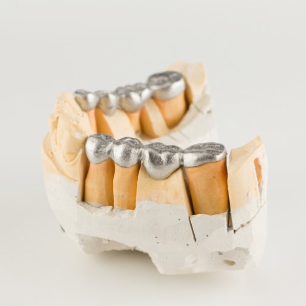 Dental Lab Outsourcing provides full-cast metal restoration