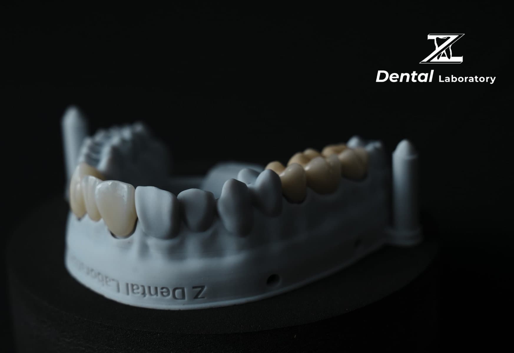 Sứ nha khoa Zirconia cho phục hình răng trước và sau