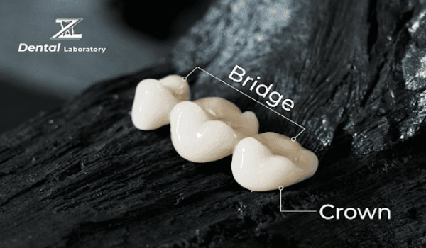 DENTAL CROWNS & BRIDGES