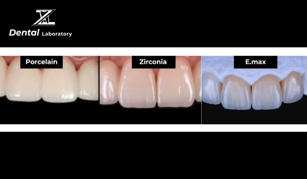 A Complete high-quality Guide to Ceramic Teeth Making: Techniques and Tips