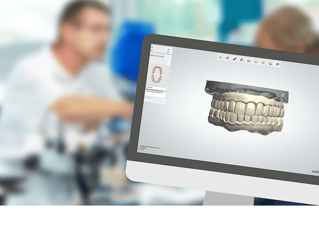 Dental CAD design companies