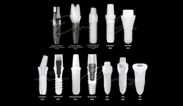 Exploring the Latest Innovations from Top Ceramic Teeth Supplier Companies